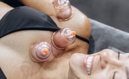 A woman enjoying a relaxing cupping therapy session for health and wellness.