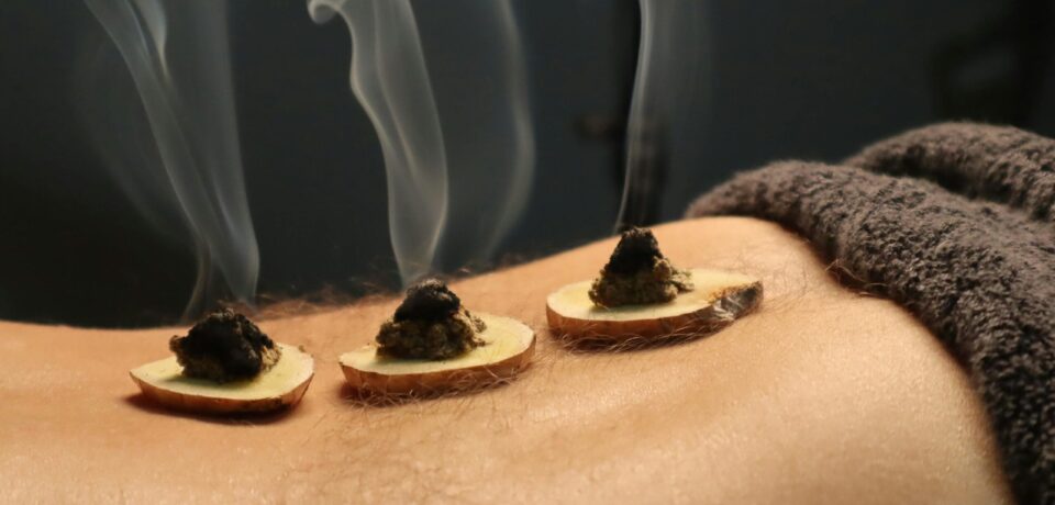 moxibustion therapie traditionelle