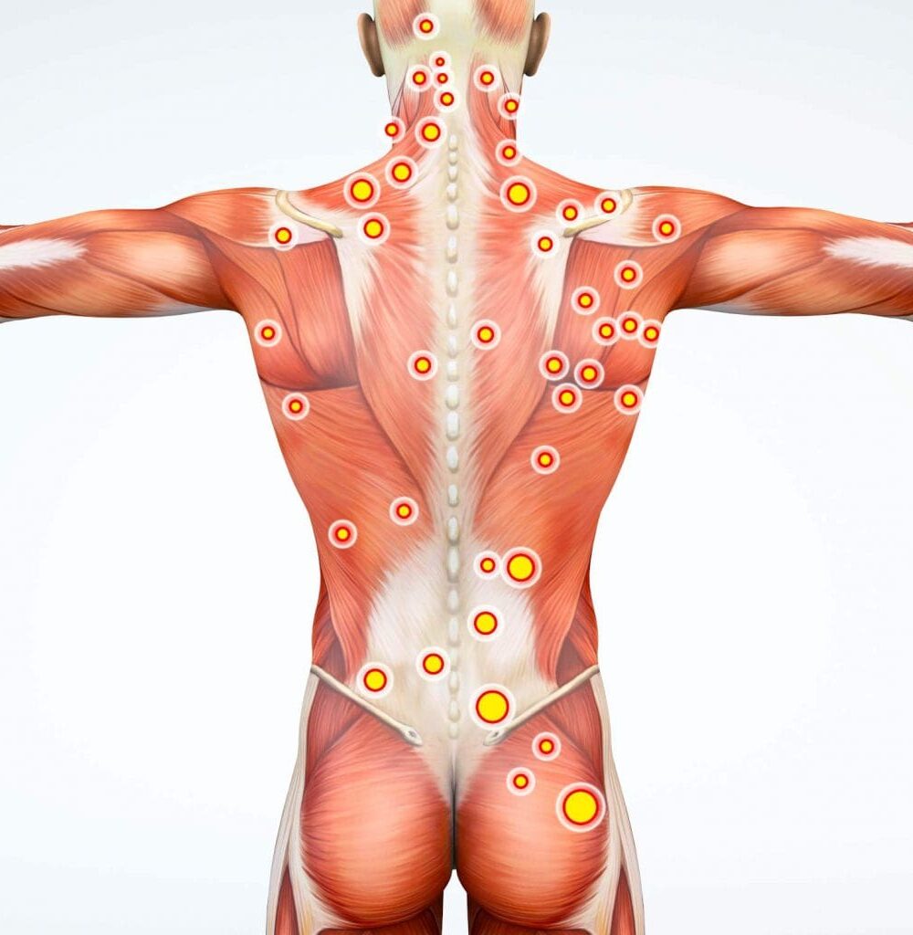 trigger-point-1024x1024