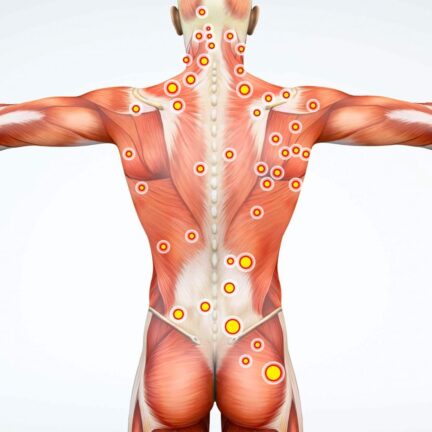 trigger-point-1024x1024