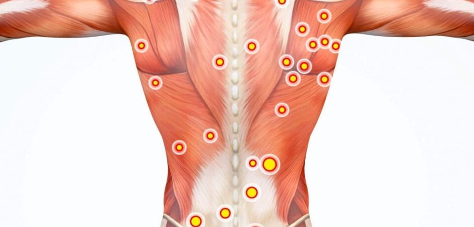 trigger-point-1024x1024